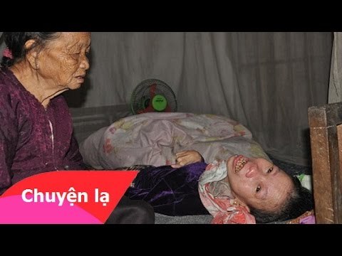 Chuyện nhân quả - Ăn thịt rắn bị rắn cắn tàn phế