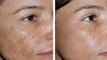 116. Two Ingredients say goodbye to wrinkles and sagging facial skin with this simple recipe. It's amazing.!