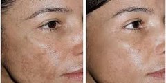 116. Two Ingredients say goodbye to wrinkles and sagging facial skin with this simple recipe. It's amazing.!