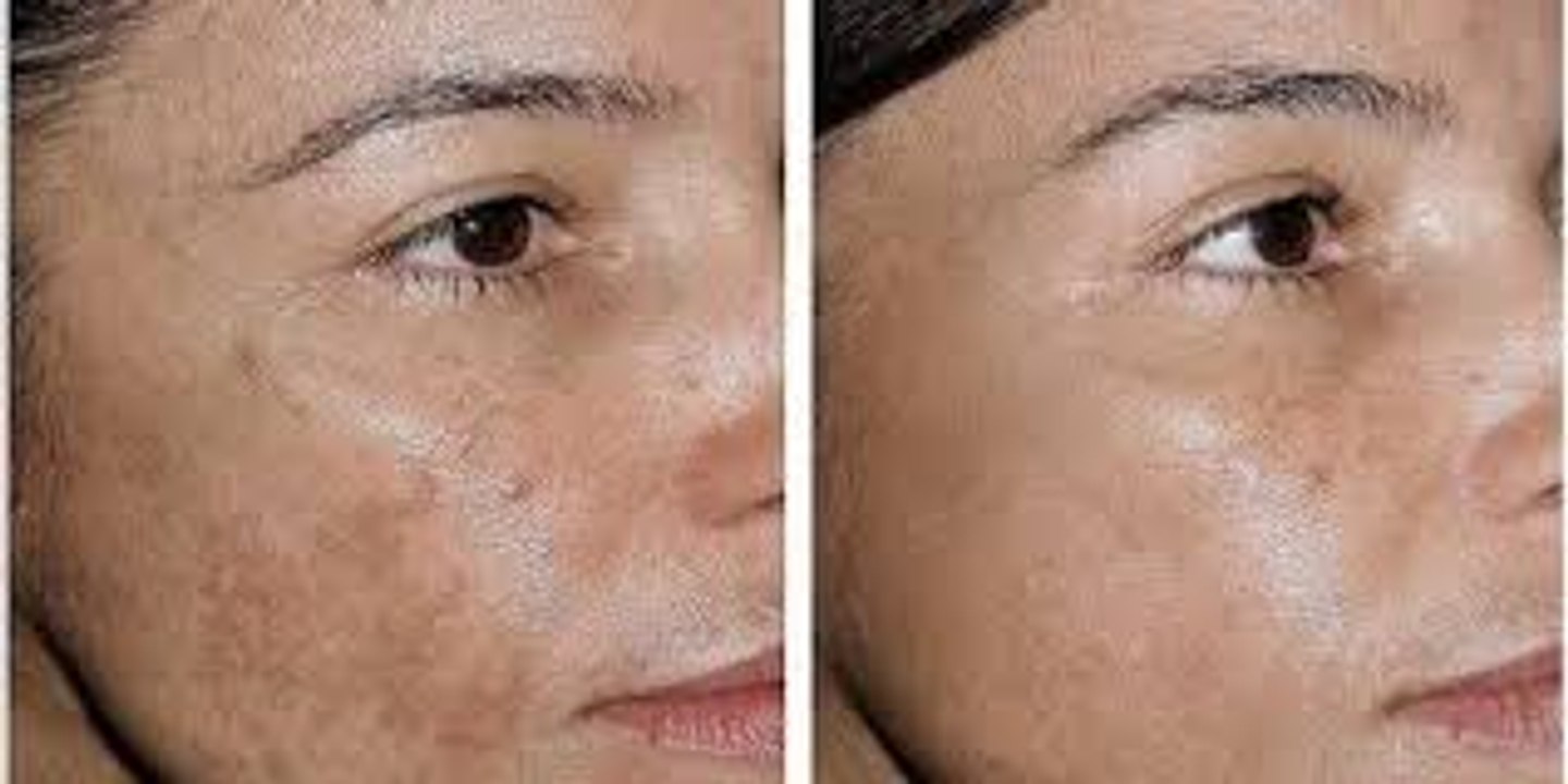 116. Two Ingredients say goodbye to wrinkles and sagging facial skin with this simple recipe. It's amazing.!