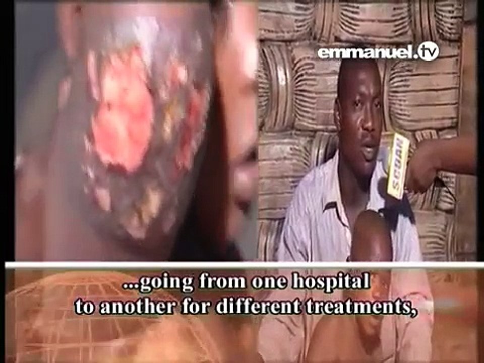 WATCH God Restoring This Arm!!!