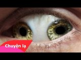 Chuyện lạ Việt Nam - Những đôi mắt kỳ lạ nhất thế giới