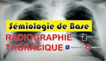 Radiographie du Thorax - Sémiologie Radiographique de Base