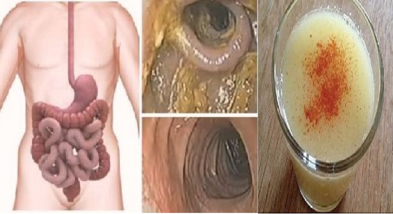 Elimine 5 quilos de toxinas do seu corpo em apenas 2 minutos com esta receita caseira!