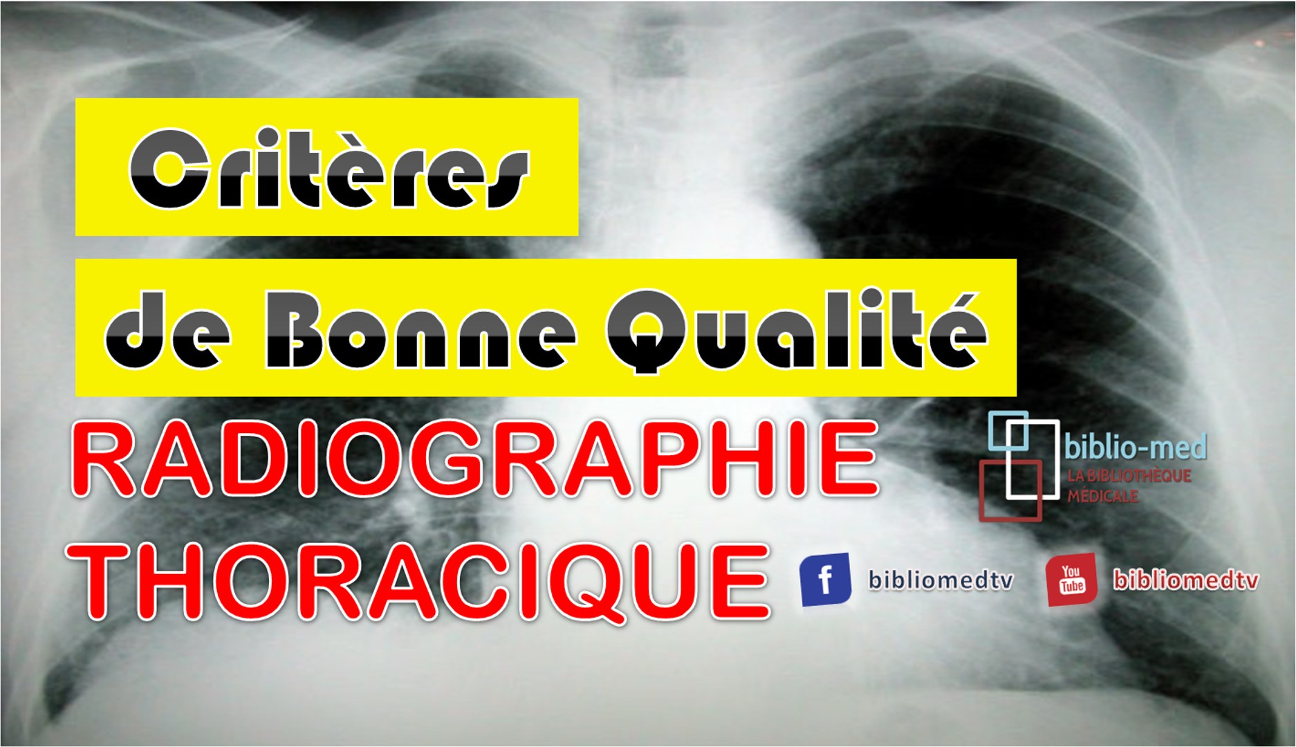Radiographie du Thorax - Critères de Bonne Qualité d'une Radiographie  Thoracique - Vidéo Dailymotion