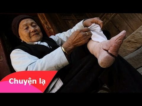 Chuyện lạ có thật – Kinh hoàng với tục lệ bó chân ở Trung Quốc