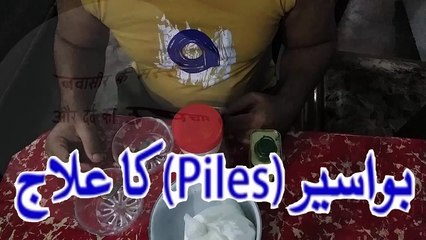 बवासीर के मस्से और दर्द का उपचार بواسیر کے مسسے اور درد کا علاج