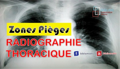 Radiographie du Thorax - Les Zones Pièges à vérifier sur une radiographie du thorax