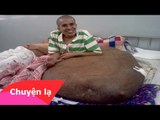 Chuyện lạ Việt Nam – Người đàn ông mang khối u 90kg