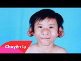 Chuyện lạ Việt Nam – Cậu bé mang khuôn mặt “Trư bát giới”
