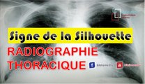 Radiographie du Thorax - Principes d’interprétation (Signe de la Silhouette)