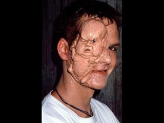 Chuyện lạ Việt Nam - Bứu hình mặt người