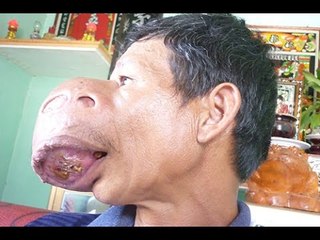 Chuyện lạ Việt Nam - Người đàn ông mặt quỷ ở Bình Định