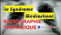 Radiographie du Thorax - Syndrome Médiastinal