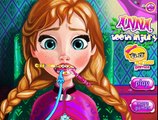 ღ la Princesa Anna Diente Lesión de Disney Congelado Dentista Juego Para las Niñas ღ