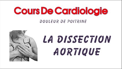 Cardiologie - Dissection Aortique