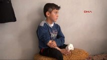 Hatay Bacakları Kopan Suriyeli Abdulbasit Protez Istiyor