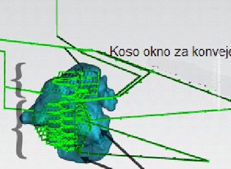 Eksploatacija rudnog tela "Čukaru Peki" metodom zarušavanja, 4. mart 2017. (RTV Bor)