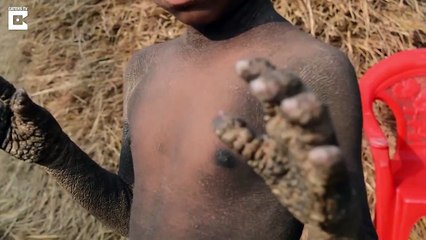 The Boy That Turned to Stone-9zZDqOHh6p4