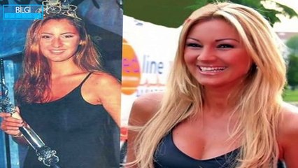 Ünlülerin Estetiksiz Hallerini Görünce Şok olacaksınız!!!