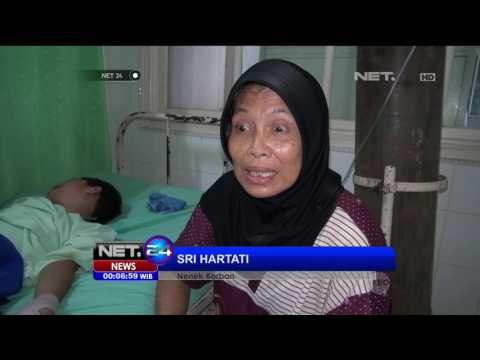 Tangan Bocah Korban Ledakan Petasan Diamputasi - NET24