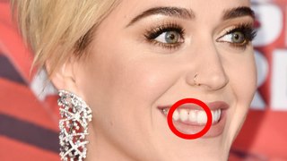 Katy Perry, com os dentes sujos, passa por saia justa em prêmio