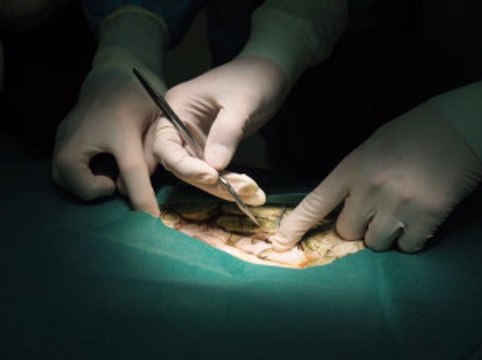 Deniz Kaplumbağasının Midesinden 915 Bozuk Para Çıktı