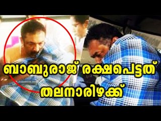 Baburaj survives stabbing - Filmibeat Malayalam