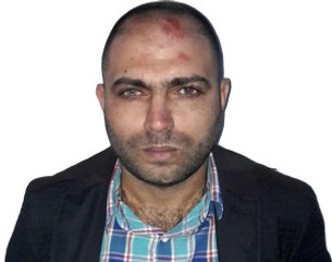 Hırsızlık Yapan Çetenin Liderini Farklı Renkteki Gözleri Ele Verdi