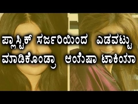 Ayesha Takia face plastic surgery did failure | Filmibeat Kannada
