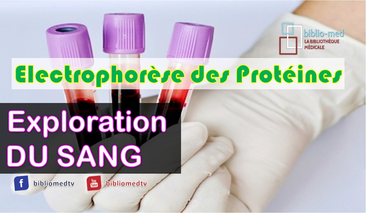 Exploration Du Sang Lectrophor Se Des Prot Ines Epp Vid O