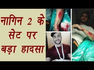 Naagin 2 actor Aryan Pandit gets injured in accident on set | FilmiBeat