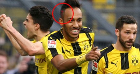Gabonlu Futbolcu Aubameyang, Saçına Reklam Aldığı İçin Tepki Çekti