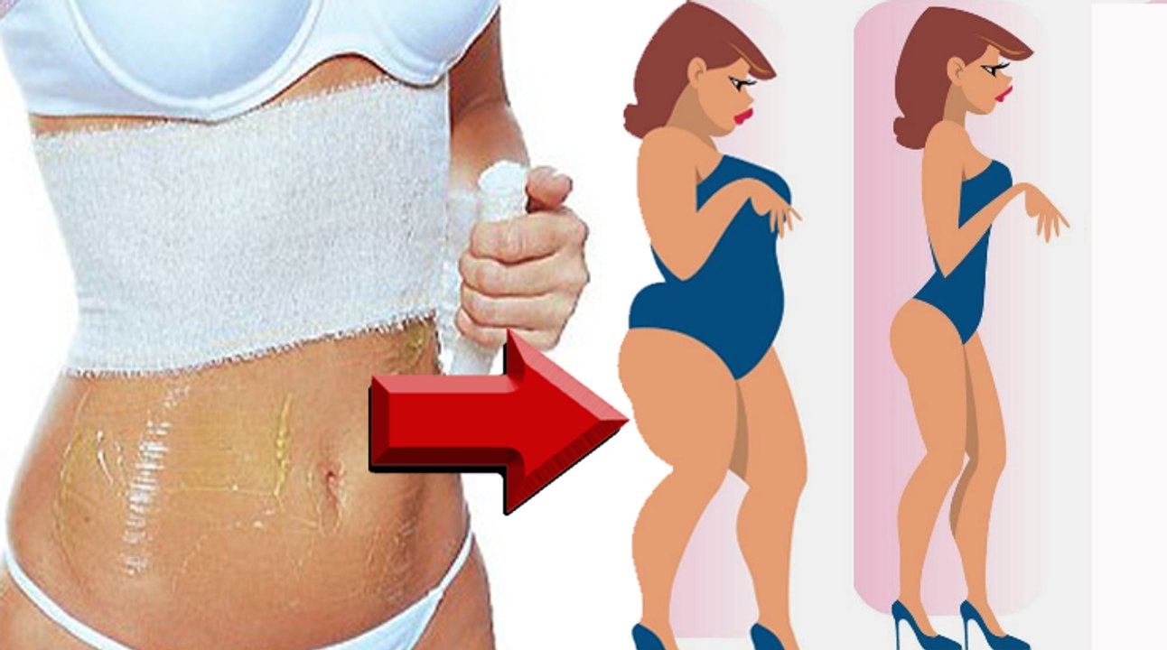 LIPO CASEIRA PARA AFINAR A CINTURA E REDUZIR MEDIDAS Lipo naturales Reduccion Nina Della Rosa