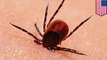 Ticks carry Lyme disease. Here’s what to do if one bites you