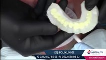 Zirkonyum Diş kaplama Tedavisi - Zirkonyum Diş kaplama Fiyatları