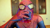 Человек-паук против нападения акул и шутник! ж/ розовый Человек-паук, замороженные Эльза супергерой в реальной жизни