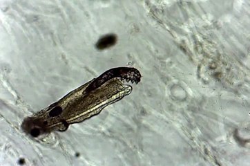 Des micro-araignées pullulent tous les jours sur votre visage
