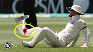 Cricket s most horrific injuries - MUST WATCH !!