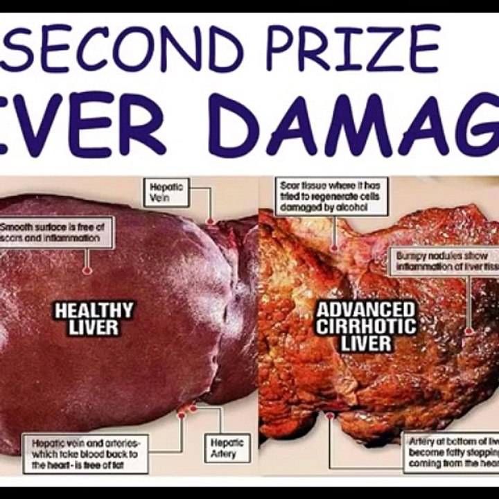 good news for all alcoholics.. get a chance win free prizes