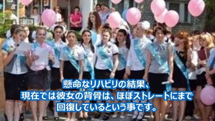 驚愕！遺伝子異常！？16歳美少女の顔から下がヤバイと話題に・衝撃！