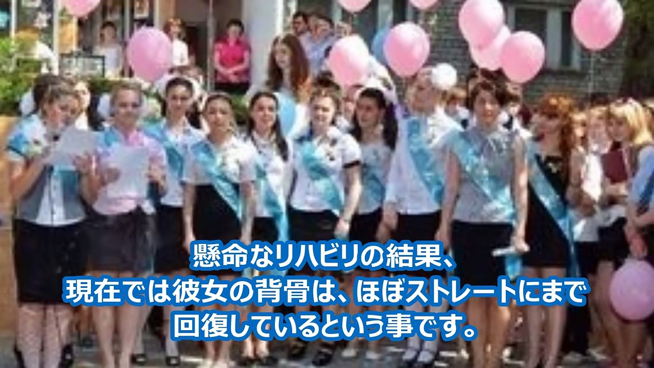 驚愕！遺伝子異常！？16歳美少女の顔から下がヤバイと話題に・衝撃！