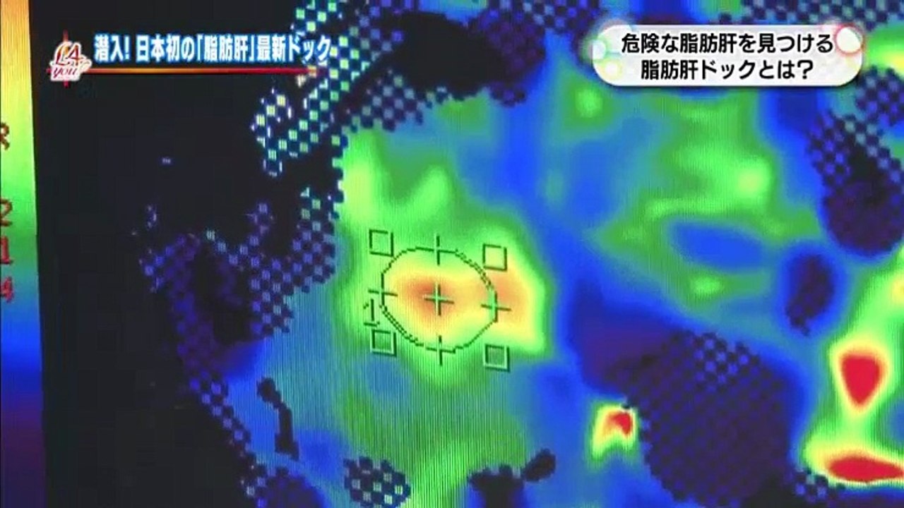 L4YOU 『急増 隠れ脂肪肝に要注意 』   2017年03月08日 170308 (23)