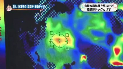 L4YOU 『急増 隠れ脂肪肝に要注意 』   2017年03月08日 170308 (23)