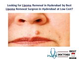 Lipoma Removal in Hyderabad