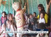 الأمراض الجلدية تغزو مخيمات النزوح في اليمن