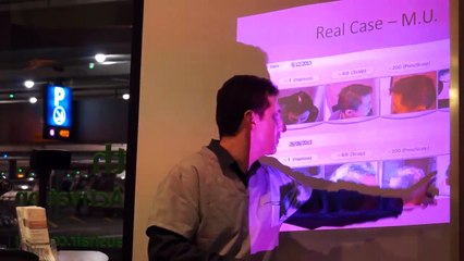 Ms Lee Hair Regrowth Case Study