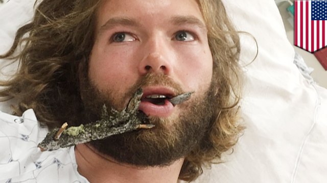 Ski accidents: Man gets impaled in face by tree branch in Wyoming