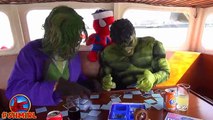 Spiderman Doctor Driving Ambulance to Hospital with Hulk Broken Leg - Funny superheroes