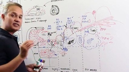 Atherosclerosis Cellular Events (Part 3)
